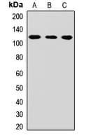 CPSF2 Antibody