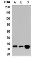 Polyclonal Rabbit anti-Human CRKL Antibody (WB)