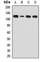 Polyclonal Rabbit anti-Human DNM2 / Dynamin-2 Antibody (IHC, WB)