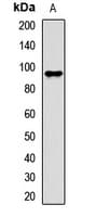 Polyclonal Rabbit anti-Human AGO2 / EIF2C2 Antibody (IHC, WB)
