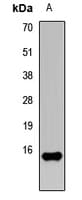 Polyclonal Rabbit anti-Human E-FABP / FABP5 Antibody (IHC, WB)