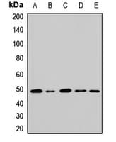 Polyclonal Rabbit anti-Human GATA2 Antibody (IHC, WB)