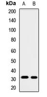 Polyclonal Rabbit anti-Human GNMT Antibody (WB)
