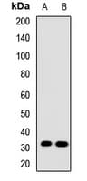 Polyclonal Rabbit anti-Human GPM6A / Glycoprotein M6A Antibody (IHC, WB)