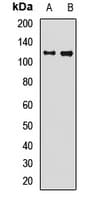 Polyclonal Rabbit anti-Human HYOU1 / ORP150 Antibody (IF, WB)