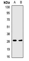 Polyclonal Rabbit anti-Human HLA-DRA Antibody (WB)