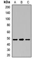 Polyclonal Rabbit anti-Human HLA-E Antibody (WB)