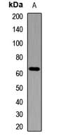 Polyclonal Rabbit anti-Human IGF2BP2 Antibody (IHC, WB)