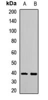 Polyclonal Rabbit anti-Human IRF2 Antibody (IHC, IF, WB)