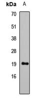 Polyclonal Rabbit anti-Human Leptin Antibody (IHC, WB)