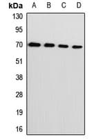 Polyclonal Rabbit anti-Human LCP1 / L-Plastin Antibody (IF, WB)