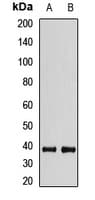 Polyclonal Rabbit anti-Human MBD3 Antibody (WB)
