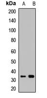 Polyclonal Rabbit anti-Human Osteoglycin / Mimecan Antibody (IHC, WB)