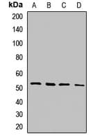 Polyclonal Rabbit anti-Human MLKL Antibody (IHC, WB)