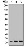 Polyclonal Rabbit anti-Human LCN2 / Lipocalin 2 / NGAL Antibody (WB)