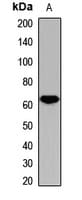 Polyclonal Rabbit anti-Human MYCN / N-myc Antibody (IHC, WB)