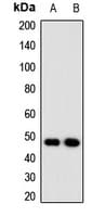 Polyclonal Rabbit anti-Human NUDT6 Antibody (IHC, IF, WB)
