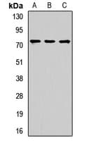 Polyclonal Rabbit anti-Human NUMB Antibody (WB)