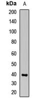 Polyclonal Rabbit anti-Human OAS1 Antibody (IHC, IF, WB)