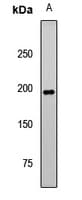 Polyclonal Rabbit anti-Human PIK3C2A Antibody (IHC, WB)