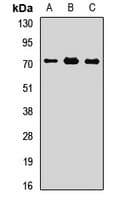 Polyclonal Rabbit anti-Human PLS3 / T Plastin Antibody (IHC, WB)