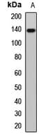 Polyclonal Rabbit anti-Human PLCB1 / Phospholipase C Beta 1 Antibody (IHC, IF, WB)