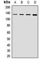 POLR2B / RPB2 Antibody
