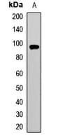 Polyclonal Rabbit anti-Human PYGM Antibody (WB)