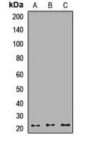 Polyclonal Rabbit anti-Human RAB1B Antibody (IHC, WB)