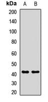 Polyclonal Rabbit anti-Human LRPAP1 Antibody (IHC, WB)