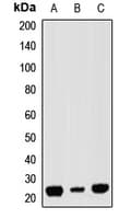 Polyclonal Rabbit anti-Human RAP1A Antibody (WB)
