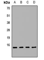Polyclonal Rabbit anti-Human REG3A Antibody (IHC, IF, WB)