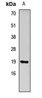 Polyclonal Rabbit anti-Human REG3G Antibody (IF, WB)