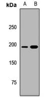 RICTOR Antibody