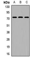Polyclonal Rabbit anti-Human RIOK2 Antibody (WB)