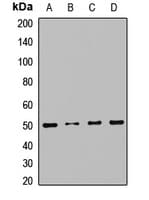 Polyclonal Rabbit anti-Human RNH1 Antibody (WB)