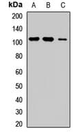 Polyclonal Rabbit anti-Human ROR1 Antibody (WB)