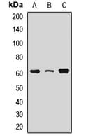 Polyclonal Rabbit anti-Human RPE65 Antibody (WB)