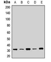 Polyclonal Rabbit anti-Human SDHB Antibody (WB)