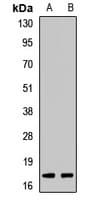 Polyclonal Rabbit anti-Human SRGN / Serglycin Antibody (IHC, IF, WB)