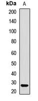 SMNDC1 Antibody