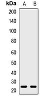 Polyclonal Rabbit anti-Human SDC2 / Syndecan 2 Antibody (IHC, WB)