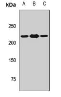 Polyclonal Rabbit anti-Human THADA Antibody (IF, WB)