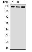 Polyclonal Rabbit anti-Human USP8 / UBPY Antibody (IF, WB)