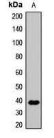 Polyclonal Rabbit anti-Human WNT3A Antibody (IHC, WB)