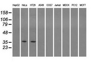 SORD / Sorbitol Dehydrogenase Antibody (clone OTI2A10)