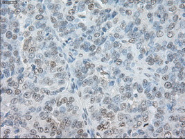SORD / Sorbitol Dehydrogenase Antibody (clone OTI2A10)