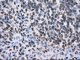 KIAA0153 / TTLL12 Antibody (clone OTI4B2)