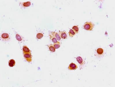 Polyclonal Rabbit anti-Human HIST1H1E Antibody (IF)