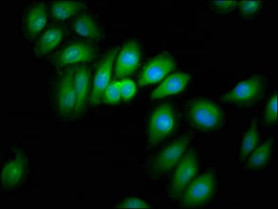 Polyclonal Rabbit anti-Human CRYM Antibody (IHC, IF)